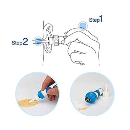 Kit eléctrico de eliminación de cera de oído C-EARS®