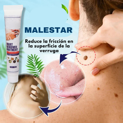 KIT-  FORMULA NATURAL PARA REMOVER VERRUGAS